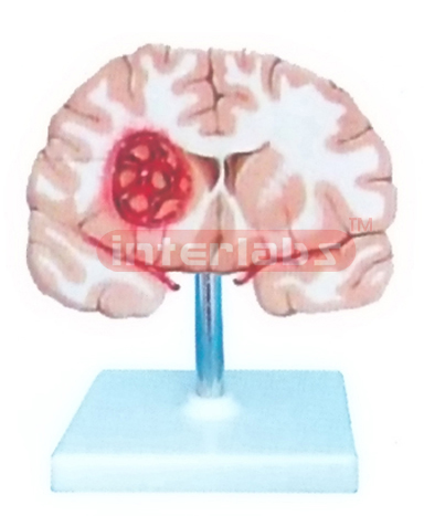 BRAIN MODEL BY SMOKE STROKING AND WIDESCRIPTION PLATE